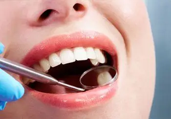 Dental examination with mirror